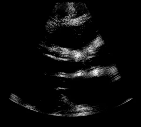 B-mode formed directly from the eight-transmit focused measurement