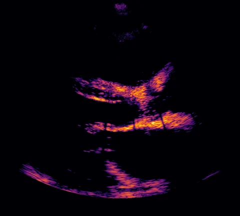 Beamformed loss between the posterior mean and the multistatic ground truth